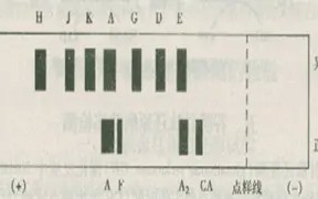 dnamarker为什么会被降解(dnamarker跑胶要核酸染料吗)